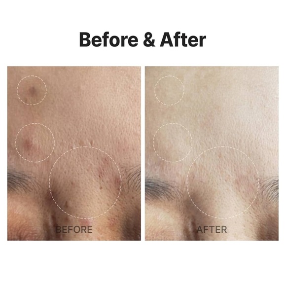 ✨BNWT - Meditherapy - A Clearing Active Panthenol 3% Cream - 80ml/2.70oz✨ - Picture 3 of 7